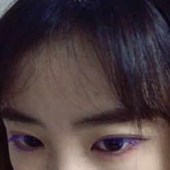 -成都西区医院整形美容