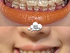 -极光口腔·矫正种植修复(锦江店)