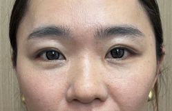 -天津健丽·去眼袋医疗美容机构
