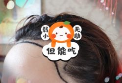 -大麦微针植发全国连锁