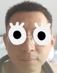 体验后-天津健丽·去眼袋医疗美容机构