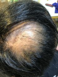 -髻尚坊增发补发织发假发定制