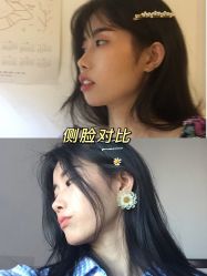 -广州美莱医疗美容医院