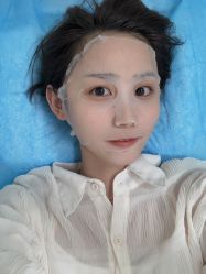-丽美妍医疗美容·皮秒·立体分层抗衰