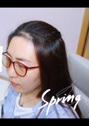 体验后-大麦微针植发全国连锁