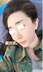-杭州米兰柏羽医疗美容医院