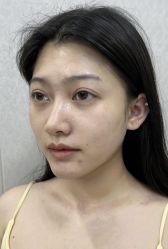 -广州曙光医学美容医院