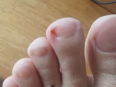 -郑远元专业修脚房·按摩·肉刺·灰指甲(苏绣路店)