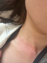 -清疣美疣·痣·斑净肤中心