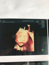 -杭州贝瑞斯美华妇儿医院·早孕·产检·儿科