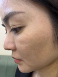 -长沙雅美医疗美容医院