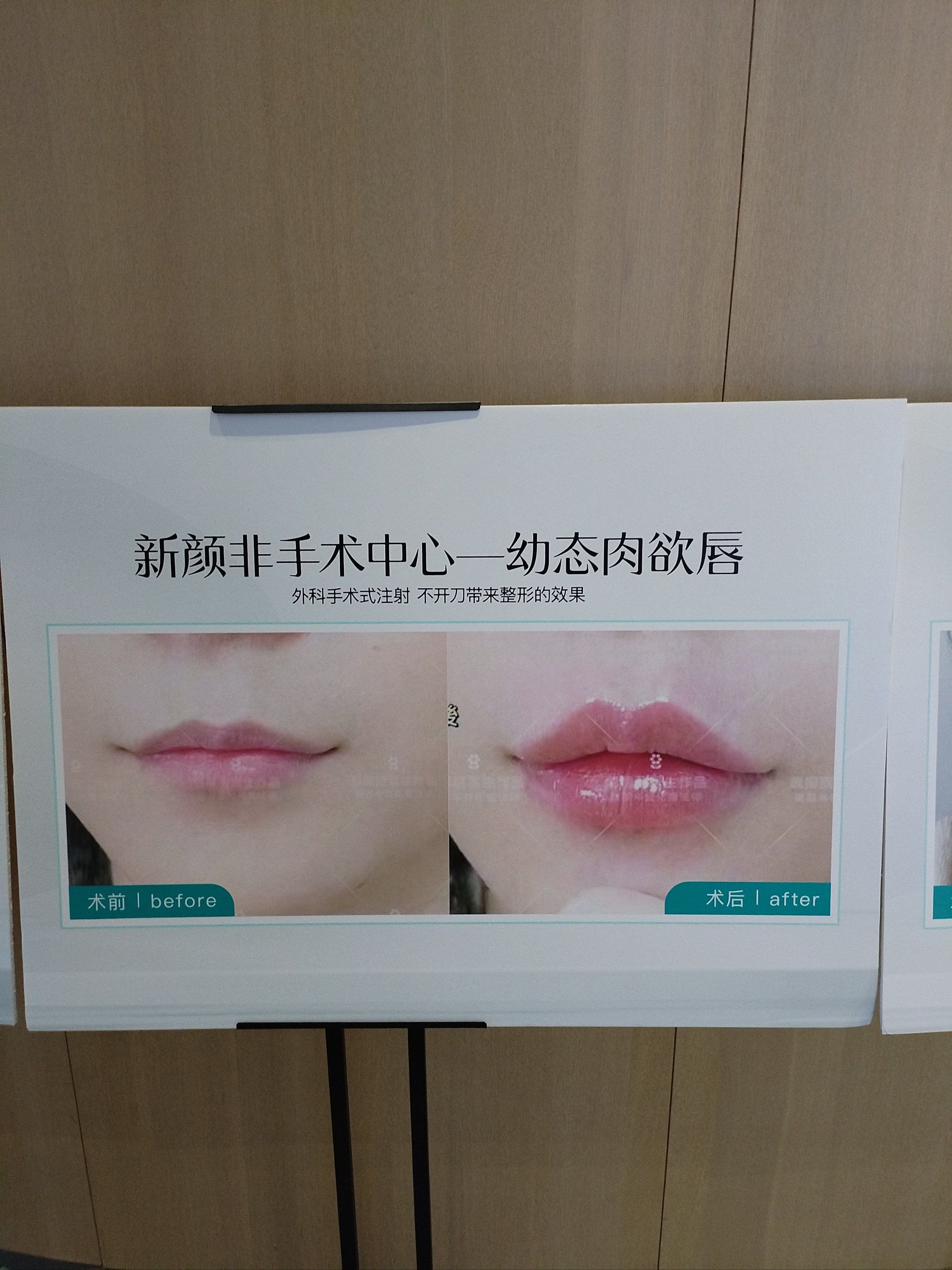 嘟嘟唇体验💋