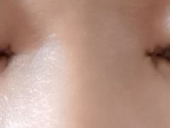 -美尔目眼科医院·近视手术·儿童近视(通州店)