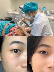 -广州健丽·去眼袋医疗美容机构