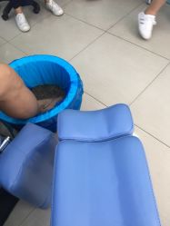 -德哥灰指甲脚气甲沟炎跖疣护理
