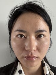 -广州健丽·去眼袋医疗美容机构