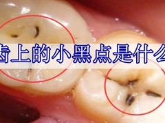 -团圆口腔·种植中心(锦江院区)