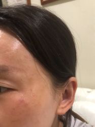 -海涛医疗美容·面部抗衰·注射美鼻