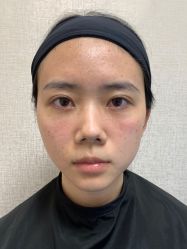 -广州健丽·去眼袋医疗美容机构