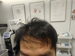 -熙朵美学植发·连锁品牌