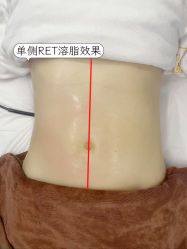 -Lily纤美·科技减脂中心