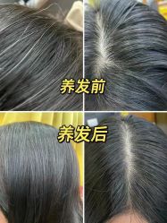 -希梵尔头皮抗衰·科技养发