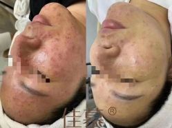 -佳慕·痘痘·问题肌调理中心