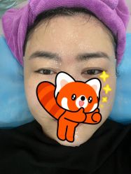 -北京米扬丽格医疗美容·联合丽格鼻整形中心