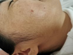 -薇兰专业脱毛连锁机构