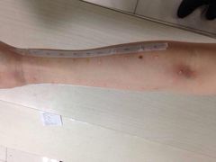 -北京市中关村医院