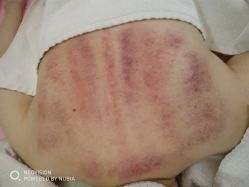 -苑苑vbeauty科技美容SPA