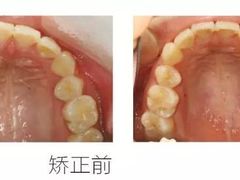 -团圆口腔·种植中心(锦江院区)