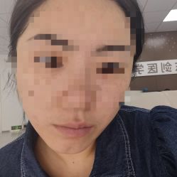 体验前-东剑医学美容·注射美学中心
