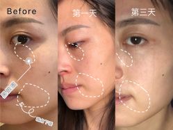 -四川娇点医学美容医院