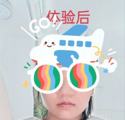 体验后-重庆联合丽格第五医疗美容医院