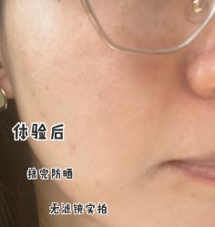 体验后-北京米扬丽格医疗美容·联合丽格鼻整形中心