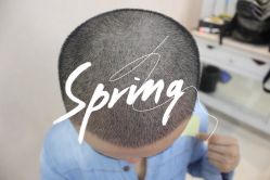 点击看大图 -大麦微针植发全国连锁