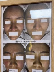 -美肤盾祛痘·问题肌头疗管理中心