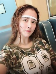 点击看大图 -大麦微针植发丨全国连锁