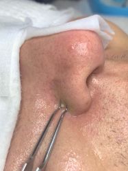 点击看大图 -苑苑vbeauty科技美容SPA