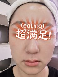 体验后-深圳美莱医疗美容医院