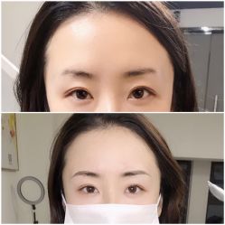 -Doris多里斯半永久纹眉·SMP纹发·发际线