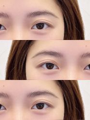 点击看大图 -杨益美学·野生眉半永久纹眉发际线