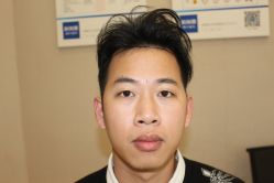 -大麦微针植发丨全国连锁