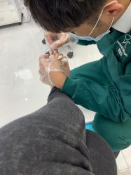 -派恩宜灰指甲鸡眼嵌甲手足癣