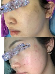 体验前-北京米扬丽格医疗美容·联合丽格鼻整形中心