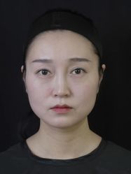 -Yestar重庆艺星医疗美容医院