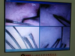 -再出发防脱发白发理疗中心