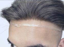 -发饰美男士增发补发假发定制店