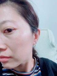 点击看大图 -亿美医疗美容·半岛大超炮官方授权店